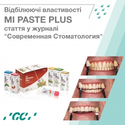 Поліпшення результатів відбілювання зубів за допомогою GC MI Paste Plus Поліпшення результатів відбілювання зубів за допомогою GC MI Paste Plus