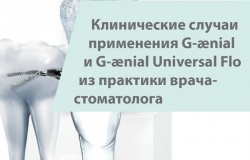 Клінічні випадки із застосуванням матеріалів сімейства G-aenial Клінічні випадки із застосуванням матеріалів сімейства G-aenial