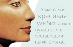Склоіономерний цемент для реставрацій порожнин III та V класу Склоіономерний цемент для реставрацій порожнин III та V класу