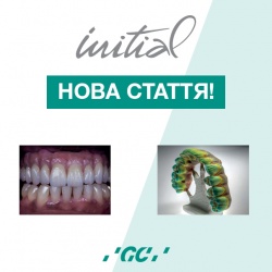 Стаття, присвячена ясенній естетиці системи INITIAL Стаття, присвячена ясенній естетиці системи INITIAL