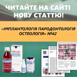 Нова стаття! "Мукогінгівальна хірургія після імплантації: коригування наслідків періімплантитів", Pedro Buitrago Нова стаття! "Мукогінгівальна хірургія після імплантації: коригування наслідків періімплантитів", Pedro Buitrago