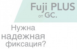 FUJI PLUS – склоіономерний цемент для фіксації №1 FUJI PLUS – склоіономерний цемент для фіксації №1