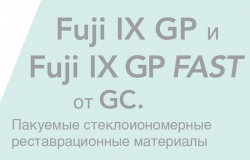 Fuji IX GP та Fuji IX GP FAST – класичні склоіономерні цементи для реставрації жувальних зубів Fuji IX GP та Fuji IX GP FAST – класичні склоіономерні цементи для реставрації жувальних зубів