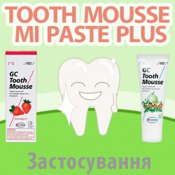 Застосування TOOTH MOUSSE / MI PASTE PLUS. Пам’ятка для пацієнта Застосування TOOTH MOUSSE / MI PASTE PLUS. Пам’ятка для пацієнта