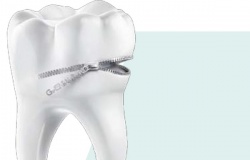 G-AENIAL Bond™ - самопротравлююча адгезивна система 7 покоління G-AENIAL Bond™ - самопротравлююча адгезивна система 7 покоління