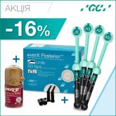 АКЦІЯ! G-aenial, everX Posterior та G-Premio BOND