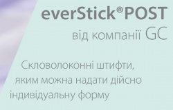 Скловолоконні штифти, яким можна надавати індивідуальну форму Скловолоконні штифти, яким можна надавати індивідуальну форму