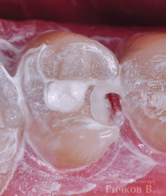 clinical_case_mal_2.jpg clinical_case_mal_2.jpg