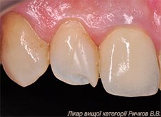 clinical_case_1.jpg clinical_case_1.jpg
