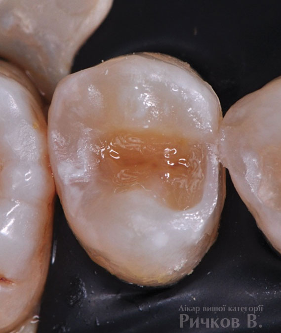 clinical_case_mal_3.jpg