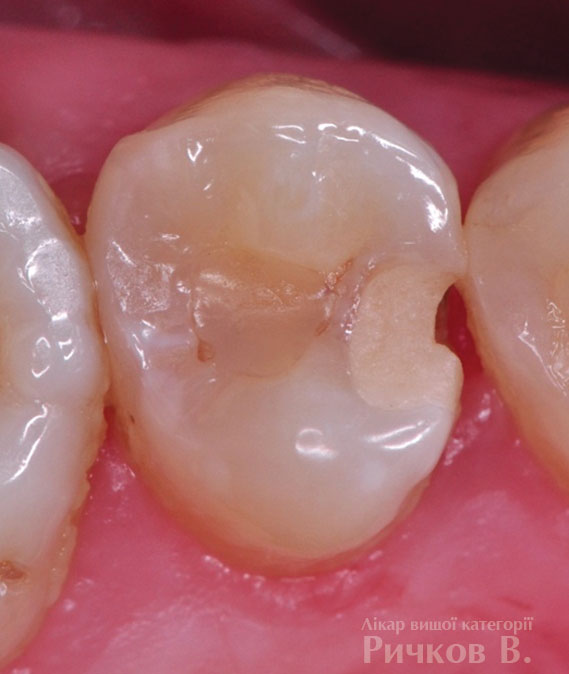 clinical_case_mal_1.jpg clinical_case_mal_1.jpg